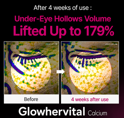 🔥LAST DAY 50% OFF!!Glowhervital Korean Calcium Dark Spot Eye Cream