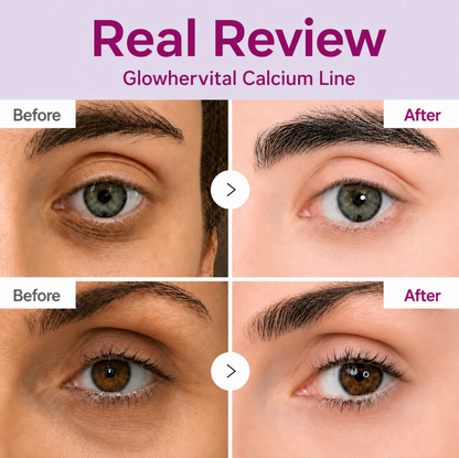 🔥LAST DAY 50% OFF!!Glowhervital Korean Calcium Dark Spot Eye Cream