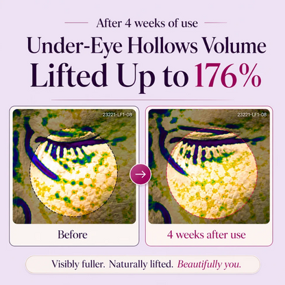 🔥LAST DAY 50% OFF!!Glowhervital Korean Calcium Dark Spot Eye Cream