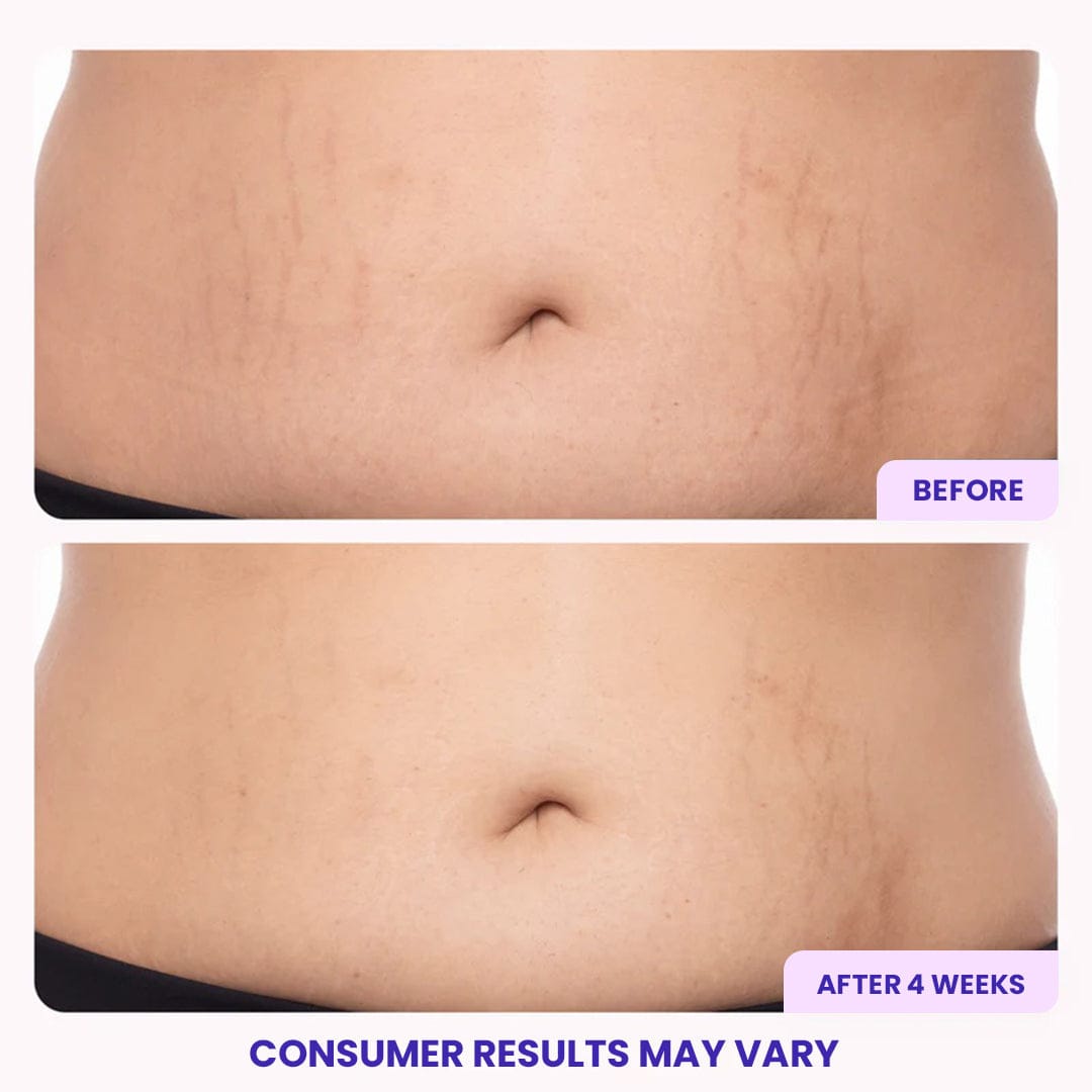 Tighten & Smooth Belly Firming Cream